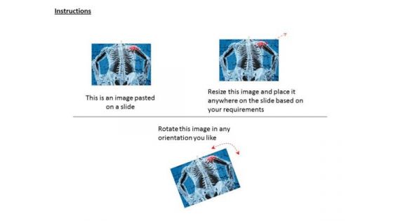 Stock Photo Shoulder With Pain Point For Human PowerPoint Slide