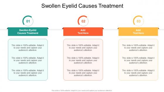 Swollen Eyelid Causes Treatment In Powerpoint And Google Slides Cpb