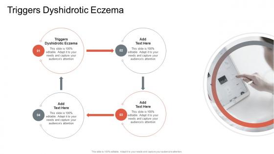 Triggers Dyshidrotic Eczema In Powerpoint And Google Slides Cpb