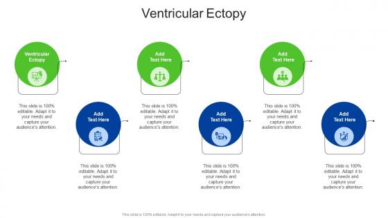 Ventricular Ectopy In Powerpoint And Google Slides Cpb