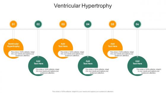Ventricular Hypertrophy In Powerpoint And Google Slides Cpb