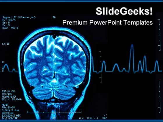 brain_mri_medical_powerpoint_template_0610_title.jpg