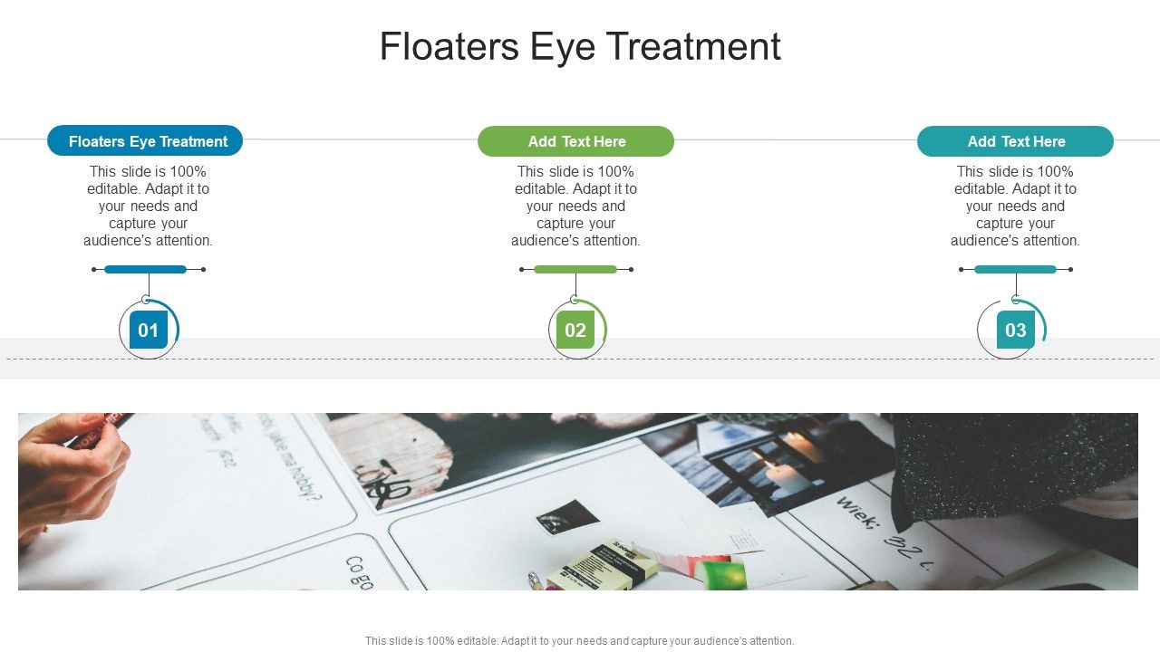 Floaters Eye Treatment In Powerpoint And Google Slides Cpb