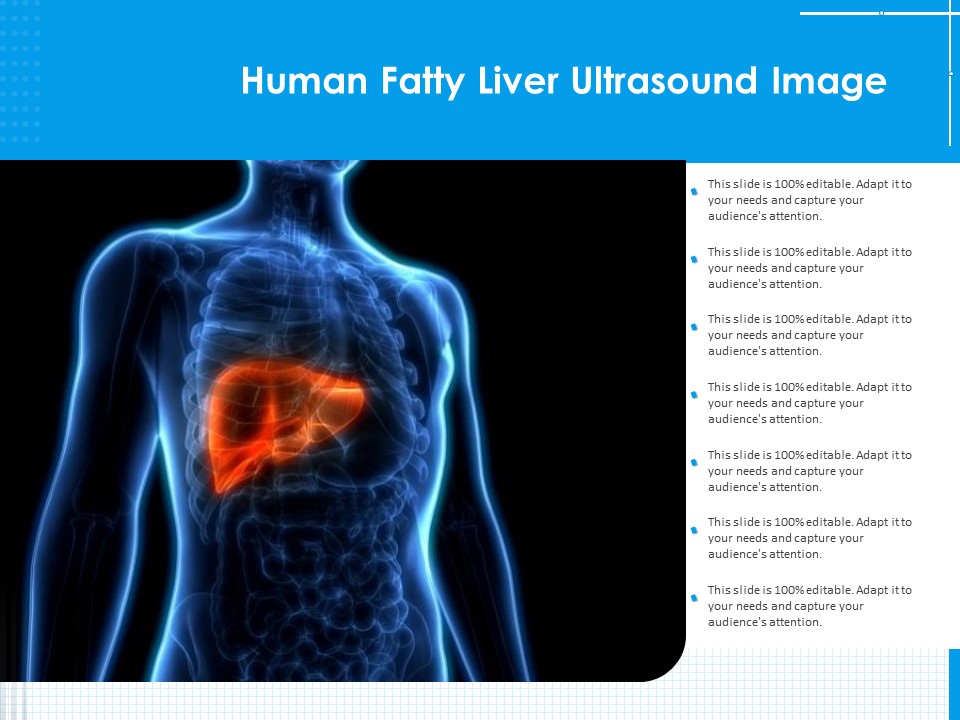 Human Fatty Liver Ultrasound Image Ppt PowerPoint Presentation File Example Topics PDF