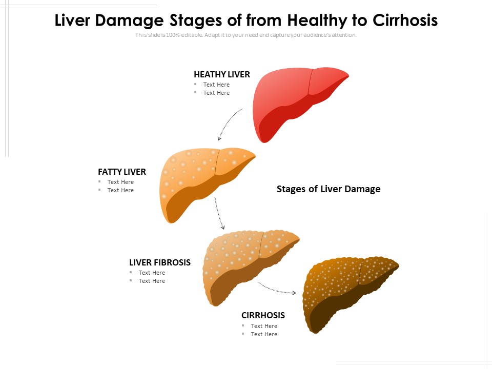 Liver Damage Stages Of From Healthy To Cirrhosis Ppt PowerPoint Presentation File Infographic Template PDF