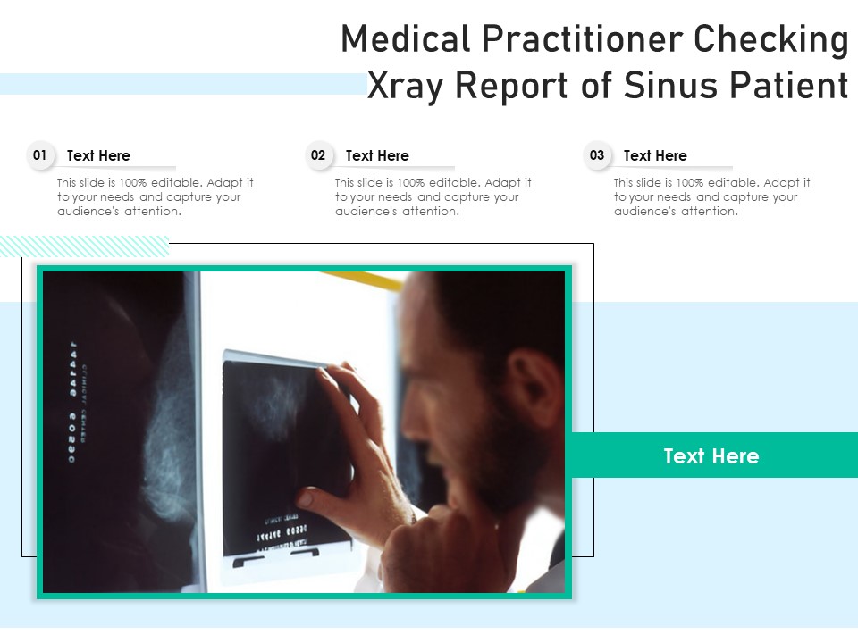 Medical Practitioner Checking Xray Report Of Sinus Patient Ppt PowerPoint Presentation Summary Microsoft PDF