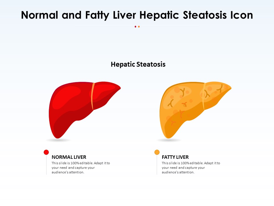 Normal And Fatty Liver Hepatic Steatosis Icon Ppt PowerPoint Presentation Gallery Tips PDF