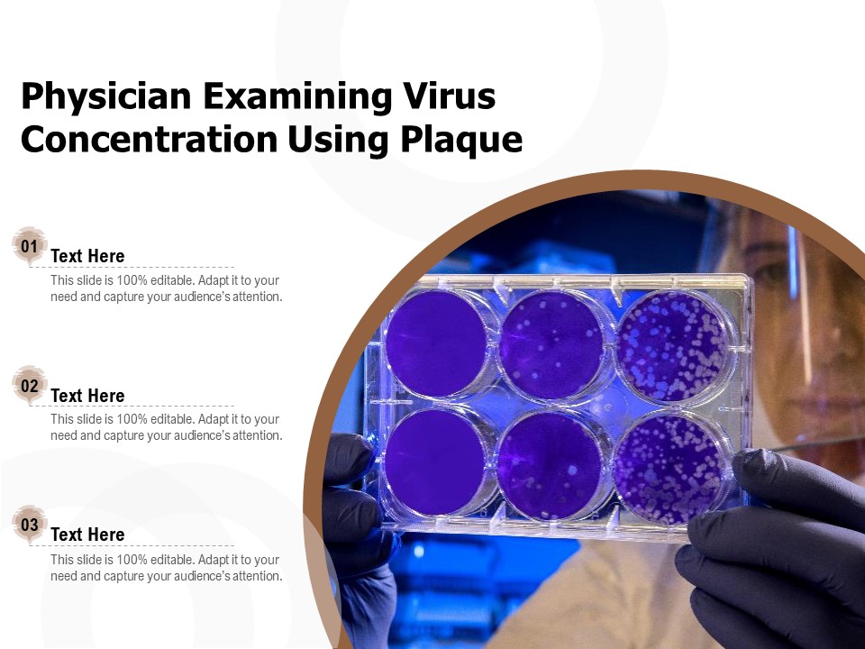Physician Examining Virus Concentration Using Plaque Ppt PowerPoint Presentation Ideas Sample PDF