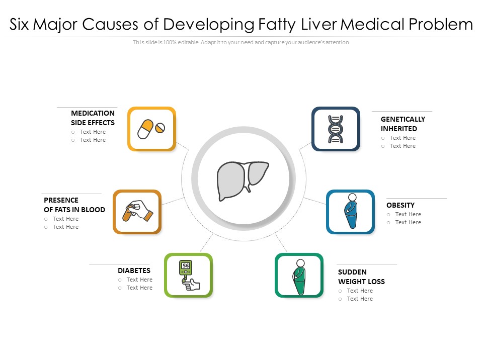 Six Major Causes Of Developing Fatty Liver Medical Problem Ppt PowerPoint Presentation Gallery Images PDF