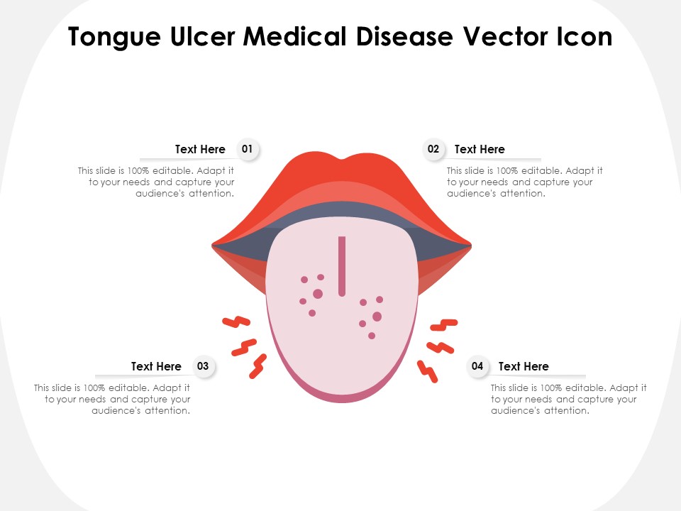 Tongue Ulcer Medical Disease Vector Icon Ppt PowerPoint Presentation File Graphics Download PDF