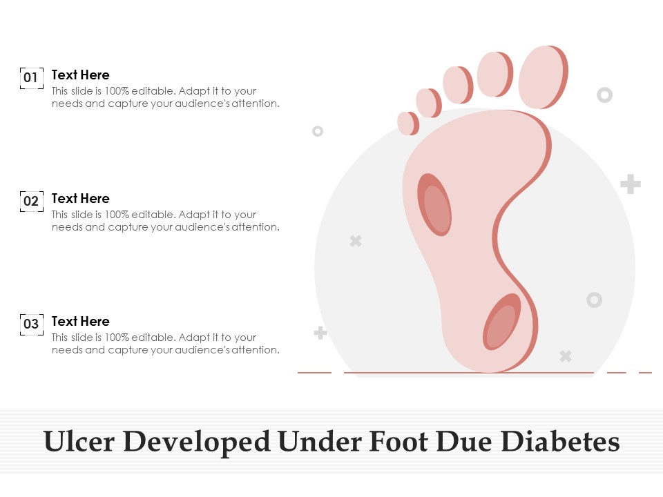 Ulcer Developed Under Foot Due Diabetes Ppt PowerPoint Presentation Pictures Objects PDF