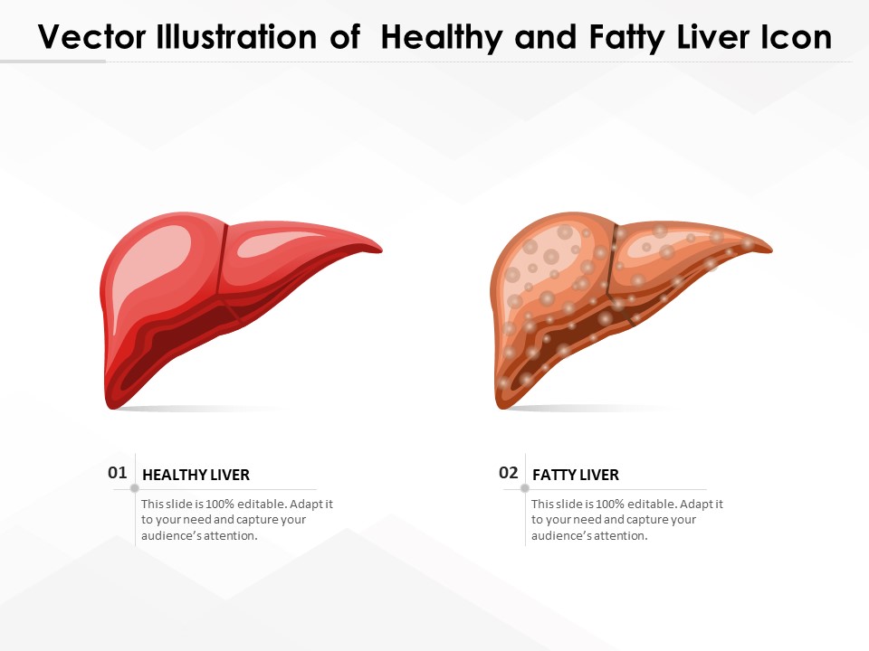 Vector Illustration Of Healthy And Fatty Liver Icon Ppt PowerPoint Presentation Gallery Ideas PDF