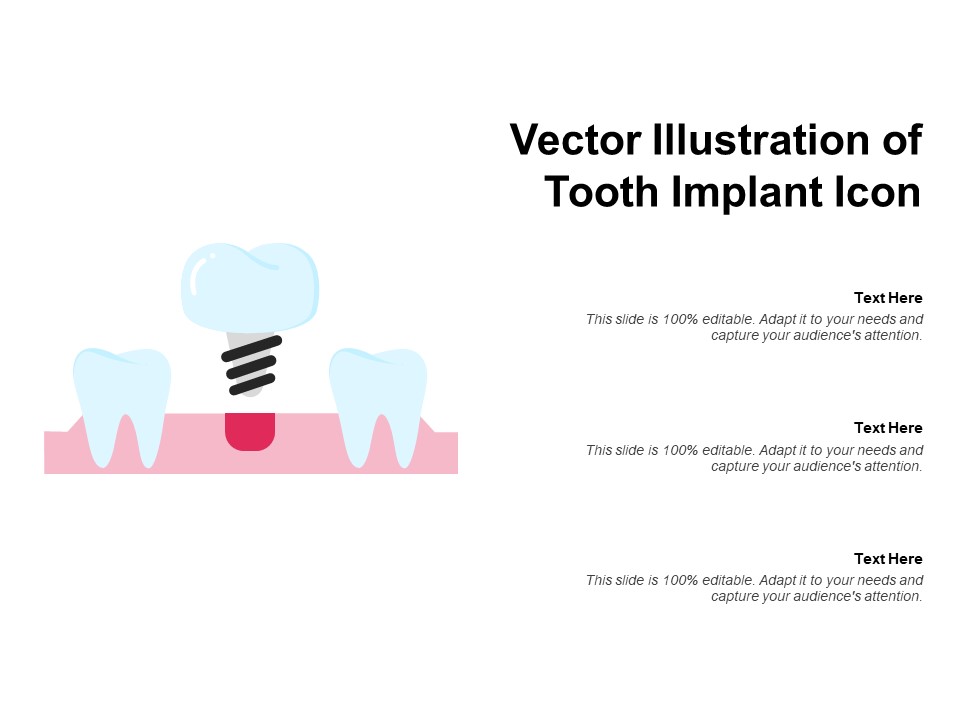 Vector Illustration Of Tooth Implant Icon Ppt PowerPoint Presentation Infographic Template Slideshow PDF
