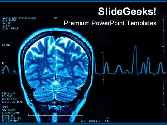Brain Mri Medical PowerPoint Template 0610