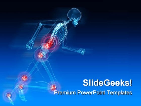 Painful Joints Medical PowerPoint Template 0610