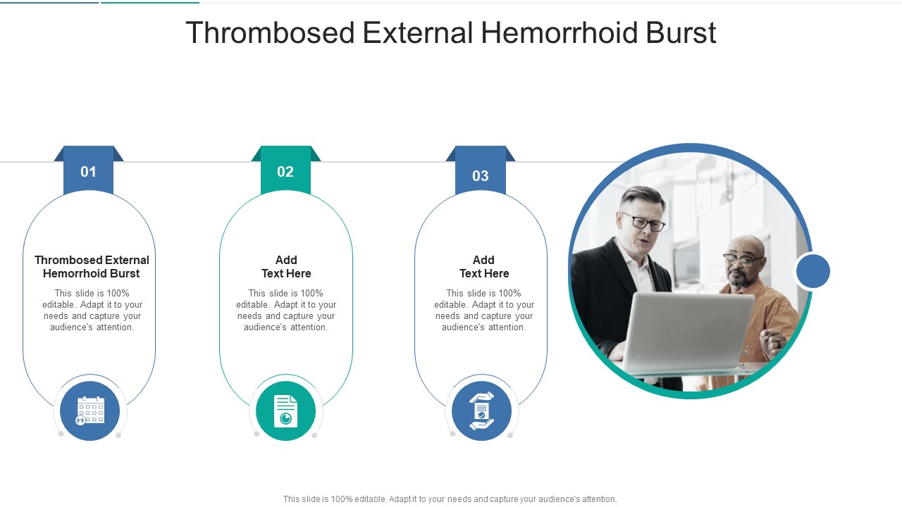 Thrombosed External Hemorrhoid Burst In Powerpoint And Google Slides Cpb