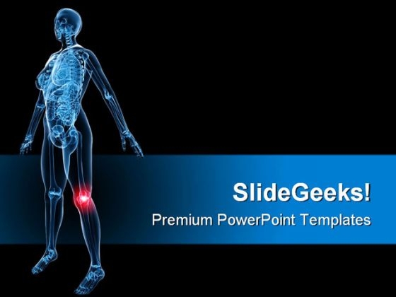 X Ray Of Painful Knee Medical PowerPoint Themes And PowerPoint Slides 0811