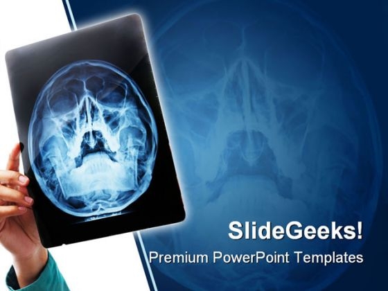 Xray Medical PowerPoint Template 0610